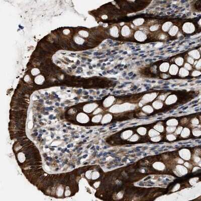 Immunohistochemistry-Paraffin: PPWD1 Antibody [NBP1-83049]