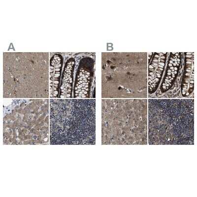 Immunohistochemistry-Paraffin: PPWD1 Antibody [NBP1-83049]