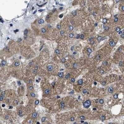 Immunohistochemistry-Paraffin: PPWD1 Antibody [NBP1-83049]