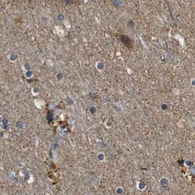 Immunohistochemistry-Paraffin: PPWD1 Antibody [NBP1-83049]
