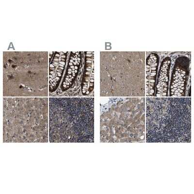 Immunohistochemistry-Paraffin: PPWD1 Antibody [NBP1-83050]
