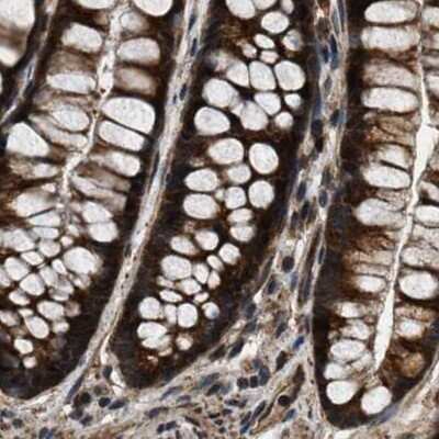 Immunohistochemistry-Paraffin: PPWD1 Antibody [NBP1-83050]