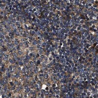 Immunohistochemistry-Paraffin: PPWD1 Antibody [NBP1-83050]