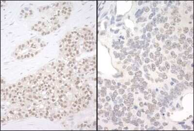 Immunohistochemistry: PQBP1 Antibody [NBP1-47271]