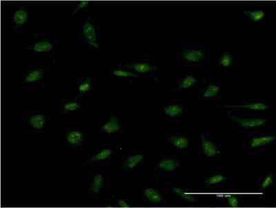 Immunocytochemistry/ Immunofluorescence: PR48 Antibody (2E12) [H00028227-M08]