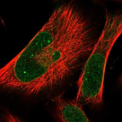 Immunocytochemistry/ Immunofluorescence: PRA1 Antibody [NBP1-80883]