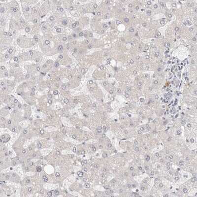 Immunohistochemistry-Paraffin: PRA1 Antibody [NBP1-80883]
