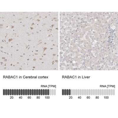 Immunohistochemistry-Paraffin: PRA1 Antibody [NBP1-80883]