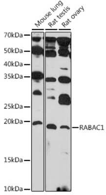 Western Blot: PRA1 AntibodyAzide and BSA Free [NBP3-15956]