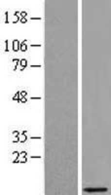Western Blot: PRAC Overexpression Lysate [NBL1-08250]