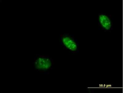 Immunocytochemistry/ Immunofluorescence: PRAF1 Antibody [H00064425-B01P]