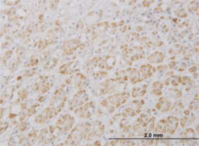 Immunohistochemistry-Paraffin: PRAGMIN Antibody (5C6) [H00157285-M01]