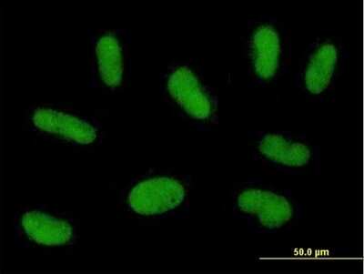 Immunocytochemistry/ Immunofluorescence: PRAM1 Antibody [H00084106-B01P]