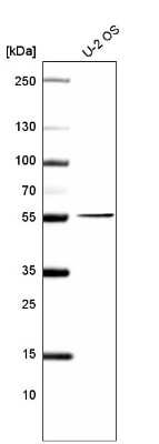 Western Blot: PRAME Antibody (CL5146) [NBP2-61148]