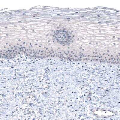 Immunohistochemistry-Paraffin: PRAME Antibody (CL5148) [NBP2-61149]