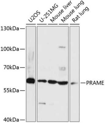 Western Blot: PRAME AntibodyAzide and BSA Free [NBP2-94496]