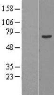 Western Blot: PRAME Overexpression Lysate [NBL1-14723]