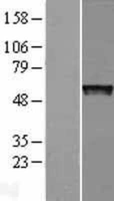 Western Blot: PRAME Overexpression Lysate [NBL1-14724]