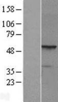 Western Blot: PRAME Overexpression Lysate [NBP2-10128]