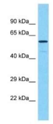 Western Blot: PRAMEF17 Antibody [NBP3-09882]