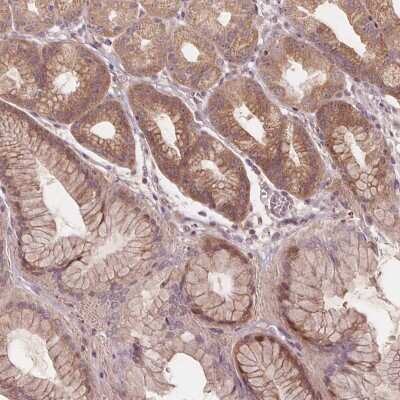 Immunohistochemistry-Paraffin: PRAS40 Antibody [NBP2-57165]