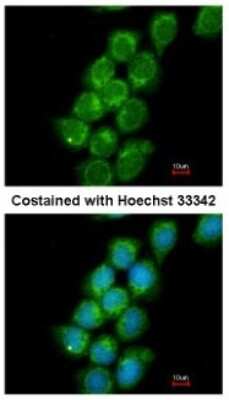 Immunocytochemistry/ Immunofluorescence: PRC1 Antibody [NBP2-19925]