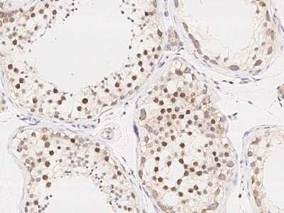 Immunohistochemistry-Paraffin: PRC1 Antibody [NBP2-99017]
