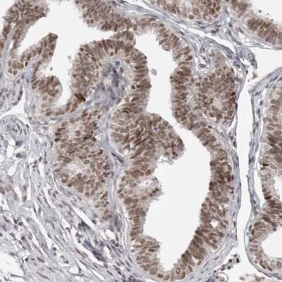 Immunohistochemistry-Paraffin: PRDM10 Antibody [NBP1-81427]