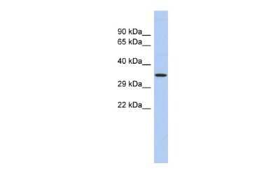 Western Blot: PRDM12 Antibody [NBP2-85531]