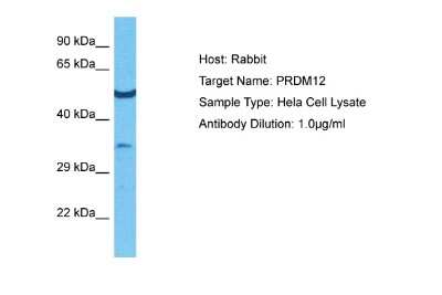 Western Blot: PRDM12 Antibody [NBP2-85531]