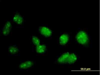 Immunocytochemistry/ Immunofluorescence: PRDM15 Antibody [H00063977-B01P]