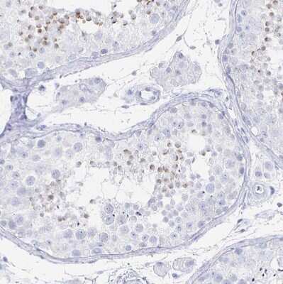 Immunohistochemistry-Paraffin: PRDM7 Antibody [NBP2-32504]