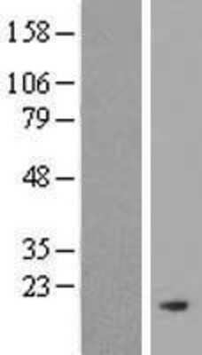 Western Blot: PRDM7 Overexpression Lysate [NBP2-05831]