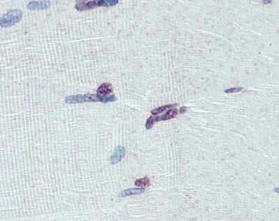 Immunohistochemistry: PRDM9 Antibody [NBP1-80118]