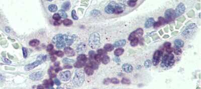 Immunohistochemistry: PRDM9 Antibody [NBP1-80118]