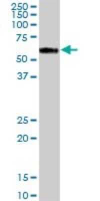 Western Blot: PRELP Antibody [H00005549-B01P]