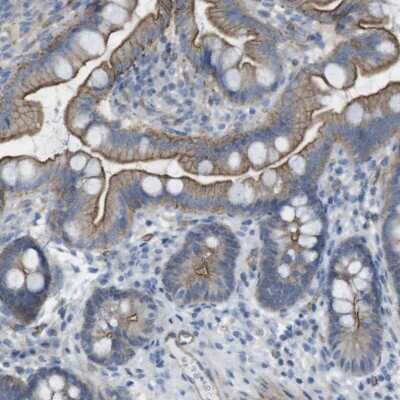 Immunohistochemistry-Paraffin: PREX2 Antibody [NBP1-84275]