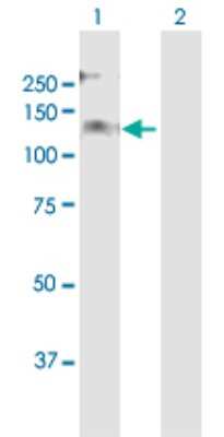 Western Blot: PREX2 Antibody [H00080243-B01P]