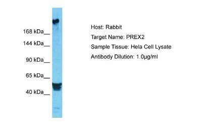Western Blot: PREX2 Antibody [NBP2-88090]