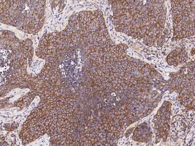 Immunohistochemistry-Paraffin: PRG-1/LPPR4 Antibody [NBP2-98915]