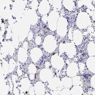 Immunohistochemistry-Paraffin: PRG3 Antibody [NBP2-38047]