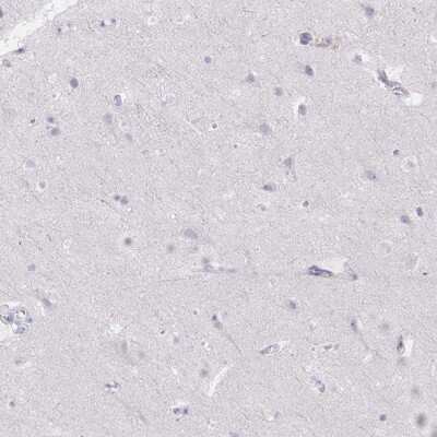 Immunohistochemistry-Paraffin: PRG3 Antibody [NBP2-38047]
