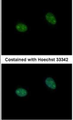Immunocytochemistry/ Immunofluorescence: PRICKLE3 Antibody [NBP1-33511]