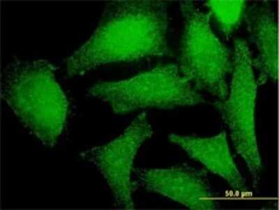 Immunocytochemistry/ Immunofluorescence: PRKAG2 Antibody (3C4) [H00051422-M01]