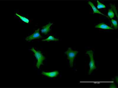 Immunocytochemistry/ Immunofluorescence: PRKAG2 Antibody [H00051422-D01P]