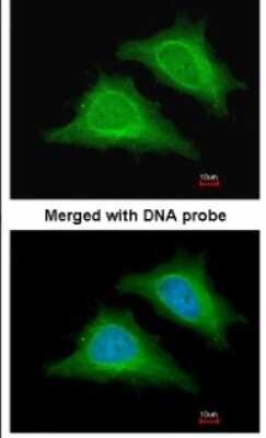 Immunocytochemistry/ Immunofluorescence: PRKAG2 Antibody [NBP1-32697]