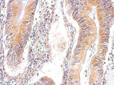 Immunohistochemistry-Paraffin: PRKAG2 Antibody [NBP1-32697]