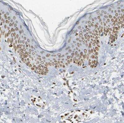 Immunohistochemistry-Paraffin: PRKAG2 Antibody [NBP1-89324]