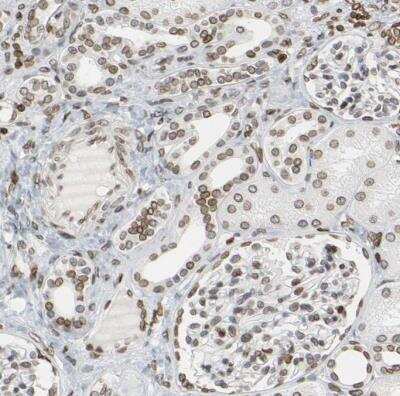 Immunohistochemistry-Paraffin: PRKAG2 Antibody [NBP1-89324]