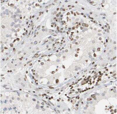 Immunohistochemistry-Paraffin: PRKAG2 Antibody [NBP1-89324]
